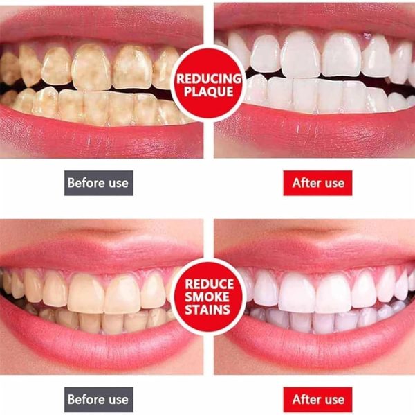 Yayashi Sp-4 Ultra Whitening Toothpaste Probiotic Stain Remover Stain Removing Toothpaste, Protects Gums Freshens Breath, For Everyone – 120 Gram